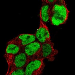Pax6 Antibody, Novus Biologicals 0.1mL; Unlabeled:Antibodies, Polyclonal